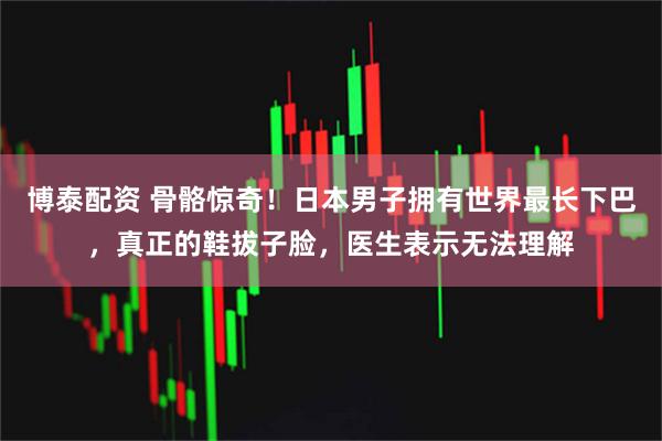 博泰配资 骨骼惊奇！日本男子拥有世界最长下巴，真正的鞋拔子脸，医生表示无法理解